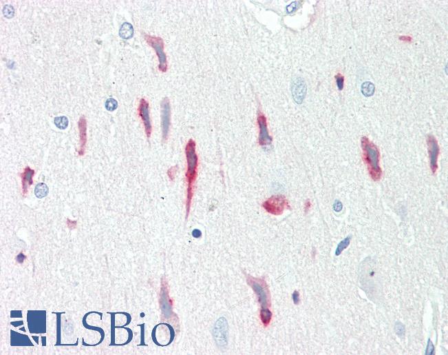 PRNP / PrP / Prion Antibody - Anti-PRNP / PrP / Prion antibody IHC staining of human brain, cortex. Immunohistochemistry of formalin-fixed, paraffin-embedded tissue after heat-induced antigen retrieval.