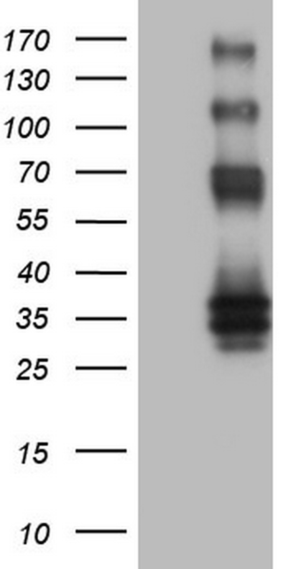 PROCR / EPCR Antibody - HEK293T cells were transfected with the pCMV6-ENTRY control (Left lane) or pCMV6-ENTRY PROCR (Right lane) cDNA for 48 hrs and lysed. Equivalent amounts of cell lysates (5 ug per lane) were separated by SDS-PAGE and immunoblotted with anti-PROCR.