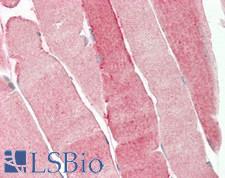 PRODH Antibody - Human Skeletal Muscle: Formalin-Fixed, Paraffin-Embedded (FFPE)