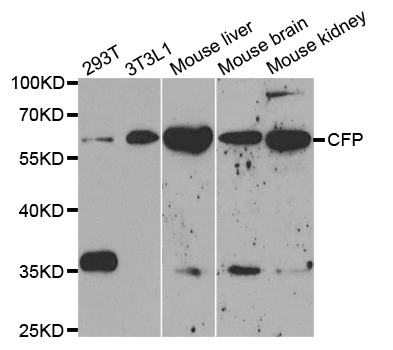 Properdin / CFP Antibody - Western blot analysis of extracts of various cell lines, using CFP antibody.