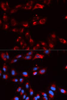 Properdin / CFP Antibody - Immunofluorescence analysis of U20S cell using CFP antibody. Blue: DAPI for nuclear staining.