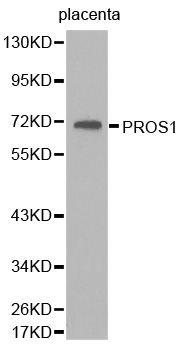 PROS1 / Protein S Antibody - Western blot analysis of extracts of human placenta tissue, using PROS1 antibody.