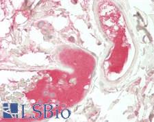 PROS1 / Protein S Antibody - Human Colon, Vessels: Formalin-Fixed, Paraffin-Embedded (FFPE)