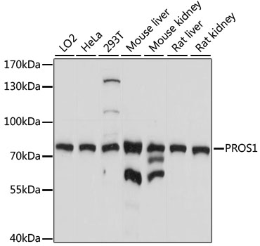 PROS1 / Protein S Antibody - Western blot analysis of extracts of various cell lines, using PROS1 antibody at 1:1000 dilution. The secondary antibody used was an HRP Goat Anti-Rabbit IgG (H+L) at 1:10000 dilution. Lysates were loaded 25ug per lane and 3% nonfat dry milk in TBST was used for blocking. An ECL Kit was used for detection and the exposure time was 5s.