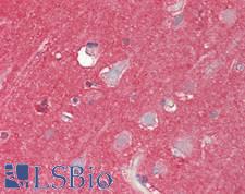 Prostaglandin D Synthase Antibody - Human Brain, Cortex: Formalin-Fixed, Paraffin-Embedded (FFPE)