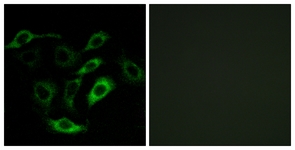 Prostaglandin D2 Receptor Antibody - Immunofluorescence of A549 cells, using PTGDR Antibody. The picture on the right is treated with the synthesized peptide.
