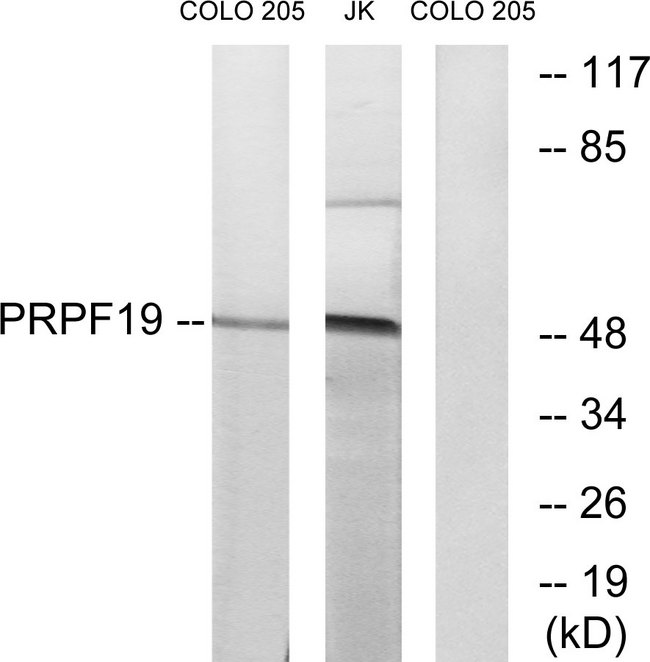 PRPF19 / PRP19 Antibody - Western blot analysis of lysates from COLO and Jurkat cells, using PRPF19 Antibody. The lane on the right is blocked with the synthesized peptide.