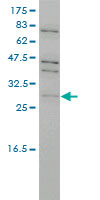 PRPK / TP53RK Antibody - TP53RK monoclonal antibody, clone 4B9-1H3 Western blot of TP53RK expression in Jurkat.