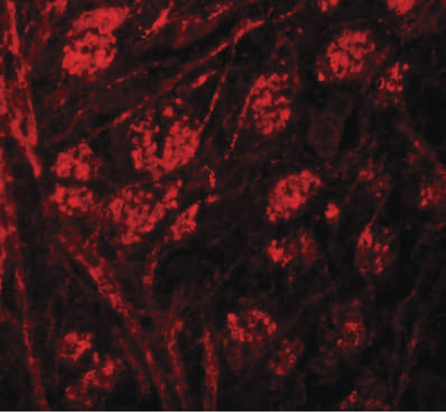 PRR5 Antibody - Immunofluorescence of PPR5 in mouse brain tissue with PPR5 antibody at 20 ug/ml.