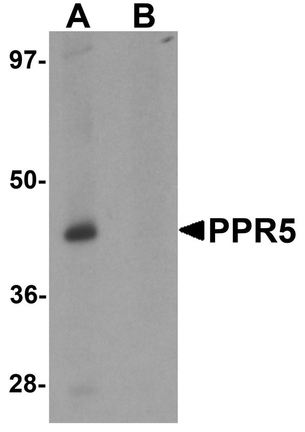 PRR5 Antibody - Western blot analysis of PRR5 in SK-N-SH cell lysate with PRR5 antibody at 1 ug/ml in (A) the absence and (B) the presence of blocking peptide