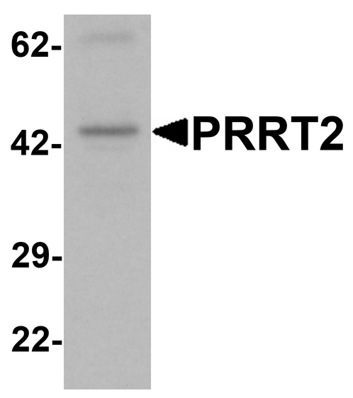 PRRT2 Antibody - Western blot analysis of PRRT2 in mouse brain tissue lysate with PRRT2 antibody at 1 ug/ml.
