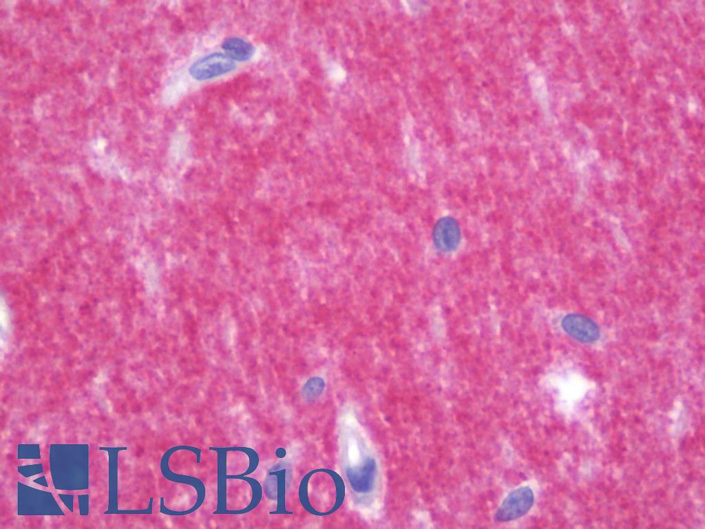 PRRT2 Antibody - Anti-PRRT2 antibody IHC staining of human brain, cerebellum. Immunohistochemistry of formalin-fixed, paraffin-embedded tissue after heat-induced antigen retrieval. Antibody concentration 10 ug/ml.