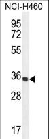 PRSS1 / Trypsin Antibody - PRSS1 Antibody western blot of NCI-H460 cell line lysates (35 ug/lane). The PRSS1 antibody detected the PRSS1 protein (arrow).