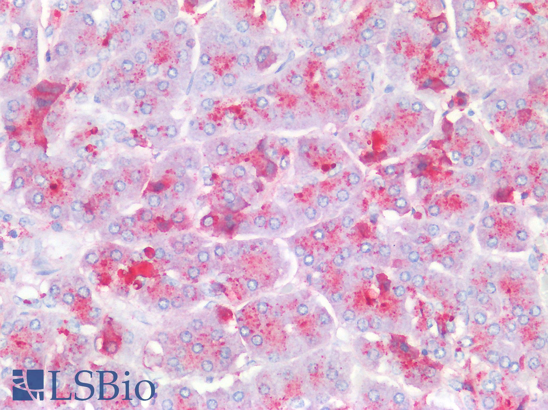 PRSS1 / Trypsin Antibody - Human Pancreas: Formalin-Fixed, Paraffin-Embedded (FFPE)