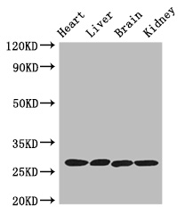 PRSS2 / Trypsin 2 Antibody - Positive WB detected in:Mouse heart tissue,Mouse liver tissue,Mouse brain tissue,Mouse kidney tissue;All lanes: PRSS2 antibody at 3ug/ml;Secondary;Goat polyclonal to rabbit IgG at 1/50000 dilution;Predicted band size: 27 kDa;Observed band size: 27 kDa;