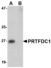 PRTFDC1 / HHGP Antibody - Western blot of PRTFDC1 in human brain tissue lysate with PRTFDC1 antibody at 1 ug/ml in the (A) absence and (B) presence of blocking peptide.