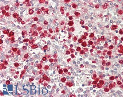 PRTN3 / Myeloblastin Antibody - Human Spleen: Formalin-Fixed, Paraffin-Embedded (FFPE)