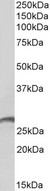 PRTN3 / Myeloblastin Antibody - PRTN3 antibody E12324 (2 ug/ml) staining of Human Spleen lysate (35 ug protein in RIPA buffer). Primary incubation was 1 hour. Detected by chemiluminescence.