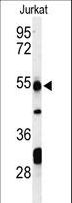 PRUNE Antibody - Western blot of PRUNE Antibody in Jurkat cell line lysates (35 ug/lane). PRUNE (arrow) was detected using the purified antibody.