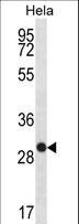PS20 / WFDC1 Antibody - WFDC1 Antibody (C-term H163) western blot of HeLa cell line lysates (35 ug/lane). The WFDC1 antibody detected the WFDC1 protein (arrow).