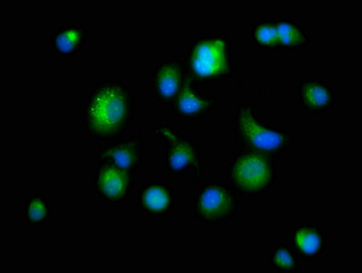 PSAP / Prosaposin Antibody - Immunofluorescence staining of MCF-7 cells with PSAP Antibody at 1:166, counter-stained with DAPI. The cells were fixed in 4% formaldehyde, permeabilized using 0.2% Triton X-100 and blocked in 10% normal Goat Serum. The cells were then incubated with the antibody overnight at 4°C. The secondary antibody was Alexa Fluor 488-congugated AffiniPure Goat Anti-Rabbit IgG(H+L).
