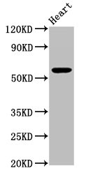 PSAP / Prosaposin Antibody - Western blot All lanes: Proactivator polypeptide antibody at 2µg/ml Lane 1: HepG2 whole cell lysate Lane 2: Hela whole cell lysate Secondary Goat polyclonal to rabbit IgG at 1/10000 dilution Predicted band size: 58 kDa Observed band size: 58 kDa