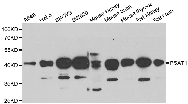 PSAT1 Antibody - Western blot analysis of extracts of various cell lines, using PSAT1 antibody.