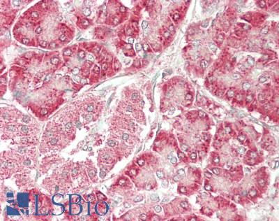 PSAT1 Antibody - Human Pancreas: Formalin-Fixed, Paraffin-Embedded (FFPE)