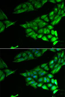 PSAT1 Antibody - Immunofluorescence analysis of U2OS cells.