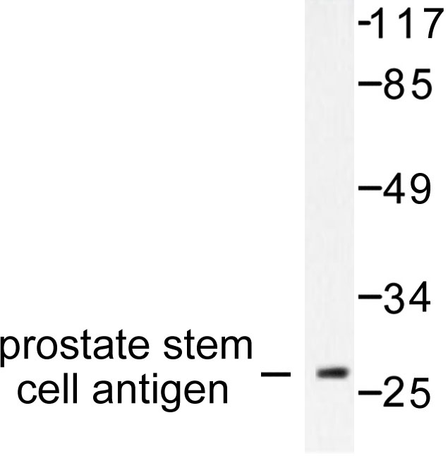 PSCA Antibody - Western blot of Prostate Stem Cell Antigen (V71) pAb in extracts from HepG2 cells.