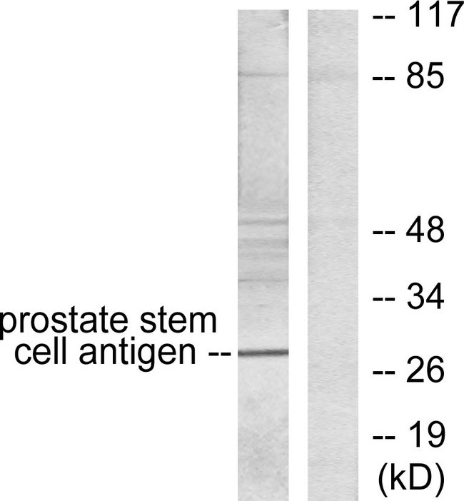 PSCA Antibody - Western blot analysis of lysates from HepG2 cells, using Prostate Stem Cell Antigen Antibody. The lane on the right is blocked with the synthesized peptide.