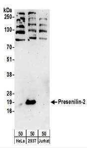 PSEN2 / Presenilin 2 Antibody - Detection of Human Presenilin-2 by Western Blot. Samples: Whole cell lysate (50 ug) from HeLa, 293T, and Jurkat cells. Antibodies: Affinity purified rabbit anti-Presenilin-2 antibody used for WB at 0.4 ug/ml. Detection: Chemiluminescence with an exposure time of 3 minutes.