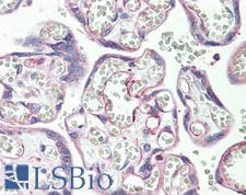PSG3 Antibody - Anti-PSG3 antibody IHC staining of human placenta. Immunohistochemistry of formalin-fixed, paraffin-embedded tissue after heat-induced antigen retrieval. Antibody dilution 1:100.