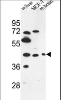 PSG3 Antibody - PSG3 Antibody western blot of MCF-7 cell line and mouse liver,brain tissue lysates (35 ug/lane). The PSG3 antibody detected the PSG3 protein (arrow).