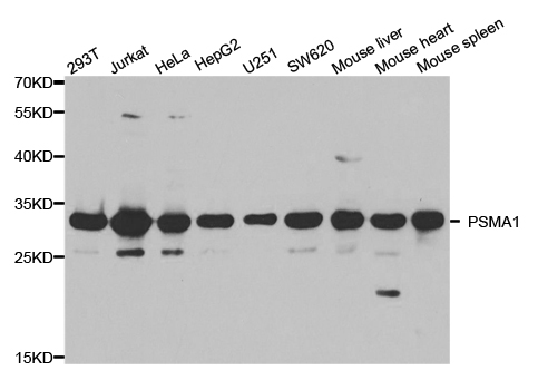 PSMA1 Antibody - Western blot analysis of extracts of various cell lines, using PSMA1 antibody.