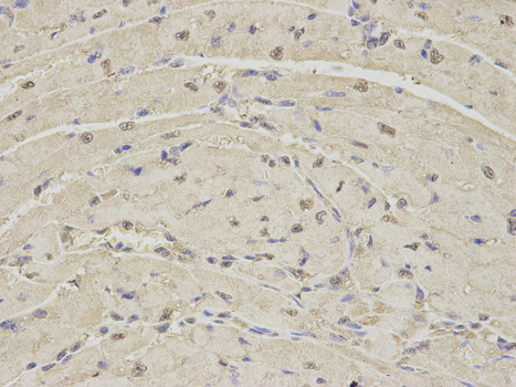PSMA1 Antibody - Immunohistochemistry of paraffin-embedded mouse heart using PSMA1 antibody at dilution of 1:100 (400x lens).