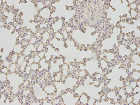 PSMA1 Antibody - Immunohistochemistry of paraffin-embedded rat lung using PSMA1 antibody at dilution of 1:100 (200x lens).