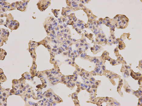 PSMA3 Antibody - Immunohistochemistry of paraffin-embedded rat lung using PSMA3 antibody at dilution of 1:200 (400x lens).