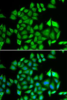 PSMA3 Antibody - Immunofluorescence analysis of U2OS cells.