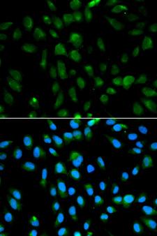 PSMA3 Antibody - Immunofluorescence analysis of MCF-7 cells using PSMA3 antibody. Blue: DAPI for nuclear staining.