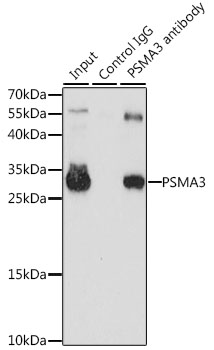 PSMA3 Antibody - Immunoprecipitation analysis of 200ug extracts of HL-60 cells, using 3 ug PSMA3 antibody. Western blot was performed from the immunoprecipitate using PSMA3 antibodyat a dilition of 1:1000.
