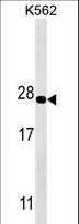 PSMA5 Antibody - PSMA5 Antibody western blot of K562 cell line lysates (35 ug/lane). The PSMA5 antibody detected the PSMA5 protein (arrow).