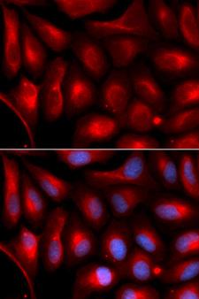PSMA5 Antibody - Immunofluorescence analysis of U20S cell using PSMA5 antibody. Blue: DAPI for nuclear staining.