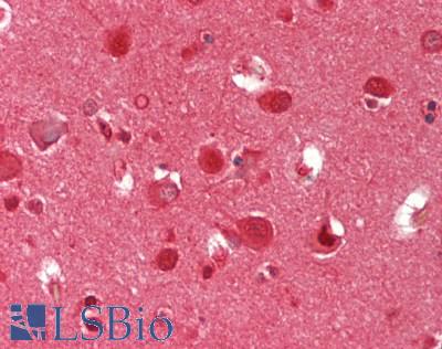 PSMA5 Antibody - Human Brain, Cortex: Formalin-Fixed, Paraffin-Embedded (FFPE)