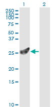 PSMA7 Antibody - Western blot of PSMA7 expression in transfected 293T cell line by PSMA7 monoclonal antibody (M01), clone 1A10-3G12.