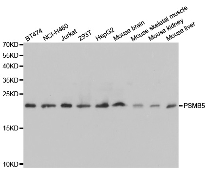 PSMB5 Antibody - Western blot analysis of extracts of various cell lines, using PSMB5 antibody.