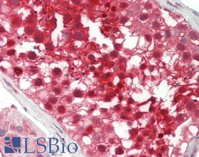 PSMB5 Antibody - Human Testis: Formalin-Fixed, Paraffin-Embedded (FFPE)