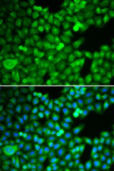 PSMB5 Antibody - Immunofluorescence analysis of MCF-7 cells.
