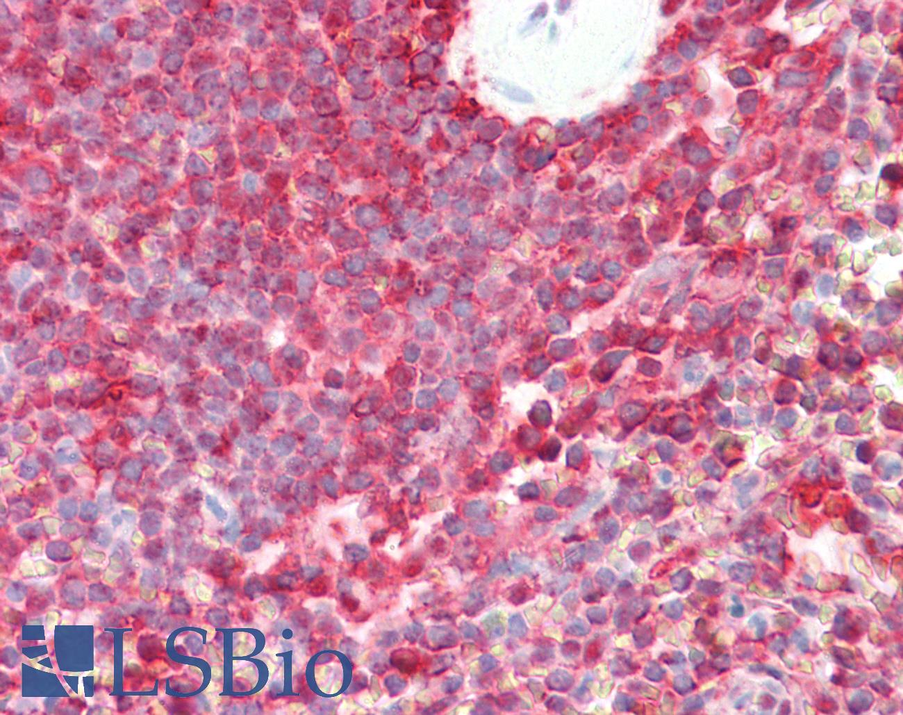 PSMB8 / LMP7 Antibody - Anti-LMP7 / PSMB8 antibody IHC staining of human spleen. Immunohistochemistry of formalin-fixed, paraffin-embedded tissue after heat-induced antigen retrieval.