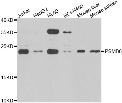 PSMB8 / LMP7 Antibody - Western blot analysis of extracts of various cell lines.